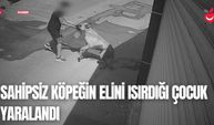 Antalya'da Sahipsiz Köpeğin Elini Isırdığı Çocuk Yaralandı