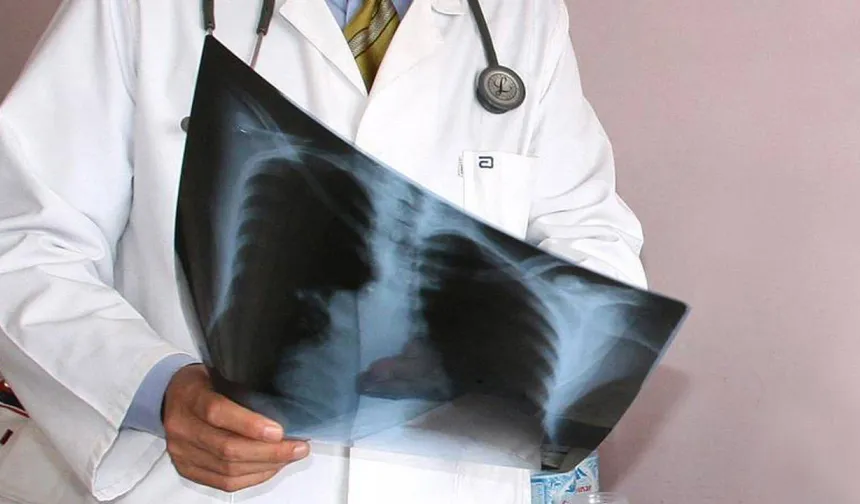 Uzman uyardı: Zatürrede erken tanı hayat kurtarıyor